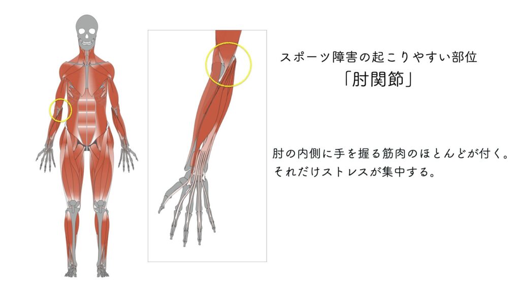 スポーツ障害　肘関節